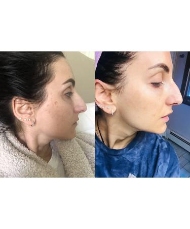 Dark Spot Corrector & Brightening Serum with Kojic Acid, Vitamin C, Salicylic Acid & More | Melasma Treatment Cream by Admire My Skin - Buy Online on GoSupps.com