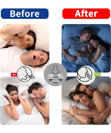 Gentle Transparent Micropore Tape 60PCS | Breathable Latex-Free Skin-Friendly for Pain-Free Removal - Buy Online on GoSupps.com