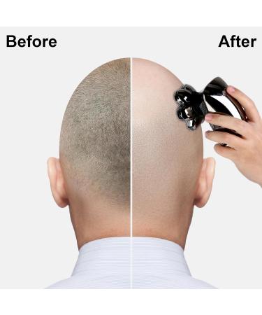 5-in-1 Electric Head Shaver for Bald Men - IPX6 Waterproof Rotary Grooming Kit with LED Display & USB Charging - Buy Online on GoSupps.com