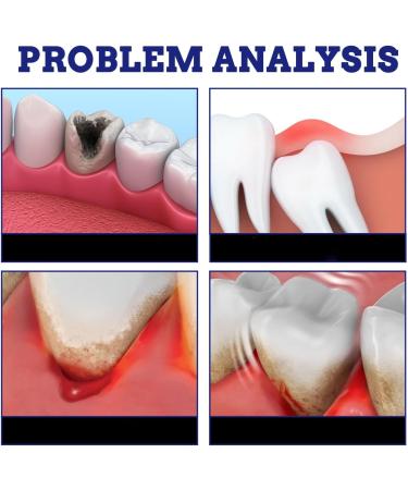 3PCS/1PCS Oral Care Spray Tooth Spray for Gum and Freshens Breath Portable & Easy to Use 0.7fl oz/pcs (3pcs) - Buy Online on GoSupps.com