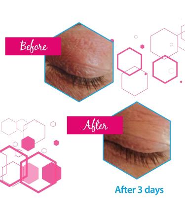 Ducray - Dexyane MeD Palpebral Cream - Dry and Atopy-Prone Eyelid Skin - Sensitive and Reactive Eyelid Skin - 15ml - Buy Online on GoSupps.com