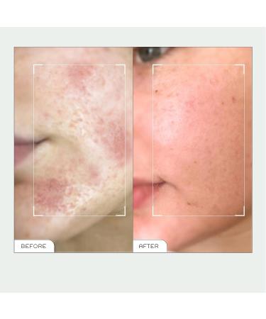 REN Clean Skincare Evercalm Overnight Recovery Balm 15ml - Hydrating Night Treatment - Buy Online on GoSupps.com