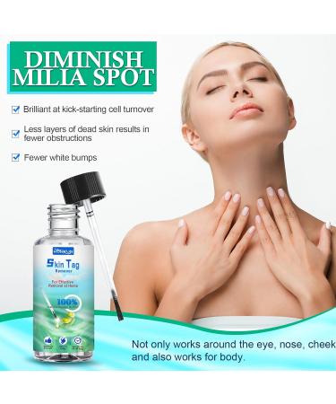 Skin Tag Removal & Wart Mole Remover Lotion 30ML - Fast-Acting & Effective - Blue - Buy Online on GoSupps.com