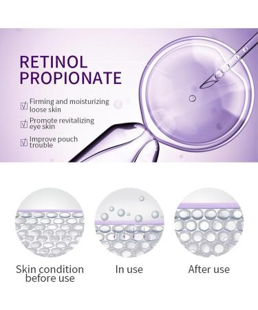 Retinol Eye Cream Under Eye Cream for Dark Circles and Puffy Eyes Moisturizing Caffeine Eye Cream Anti Aging Against Wrinkles Dark Circle Eye Cream for Men and Women Eye Bags Remover - Buy Online on GoSupps.com
