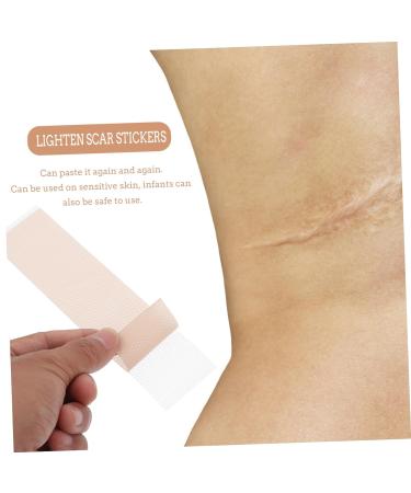 2pcs Waterproof Silica Gel Scar Repair Tape | Silicone Scar Strips Patch Bandages for Body | Nursing Stickers for Scar Management - Buy Online on GoSupps.com
