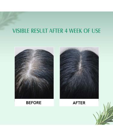 Buy 100% Pure Rosemary Lavender Hair Oil - Promote Hair Growth & Control Hair Fall - Natural Oil for Healthy Scalp & Hair - 6.7 FL Oz (200 ml) - International Shipping - Buy Online on GoSupps.com