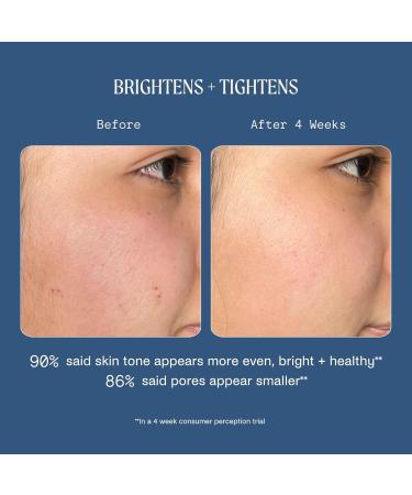 Buy Kinship Dreamwave 2% Bio-Retinoid Overnight Renewal Serum - Anti-Aging for Sensitive Skin Smooth Wrinkles & Brighten Complexion - 1 Oz | Free International Shipping - Buy Online on GoSupps.com
