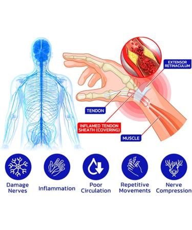 Gfouk Numbfix Hands and Foots Spray for Discomfort Caused by Joints Numbfix Hands and Foots Spray for Applies to Everyone Relieves Various Joint Pains (3pcs) - Buy Online on GoSupps.com