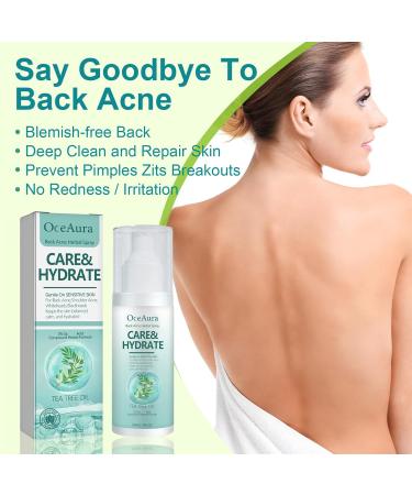 Back Acne Treatment Spray Back & Body Acne Treatment Acne Body Spray Tea Tree Oil for Skin Smooth Moisturiser for Acne Prone Skin Acne Moisturiser Gentle Repair Back Shoulder/Body /Chest /Butt - Buy Online on GoSupps.com