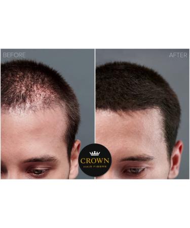 CROWN Hair Fibers for Thinning Hair (BLACK) - Instantly Thickens & Conceals Balding Areas - Natural Keratin Hair Loss Solution - 0.87oz/25g Bottle - Buy Online on GoSupps.com