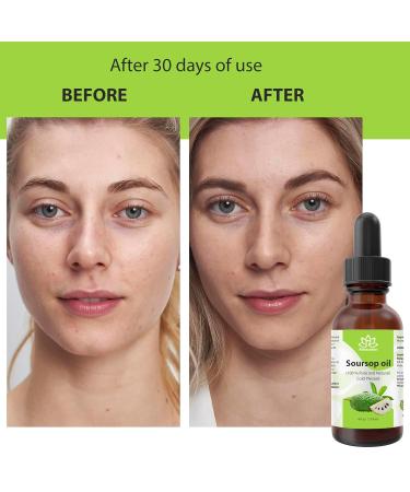 Relaxcation Soursop Oil 100% Pure Cold Pressed Graviola Guanabana Seed Oil Virgin & Unrefined Lightweight Skin Extract for Face Body & Massage (0.5 oz) 0.5 Fl Oz (Pack of 1) - Buy Online on GoSupps.com