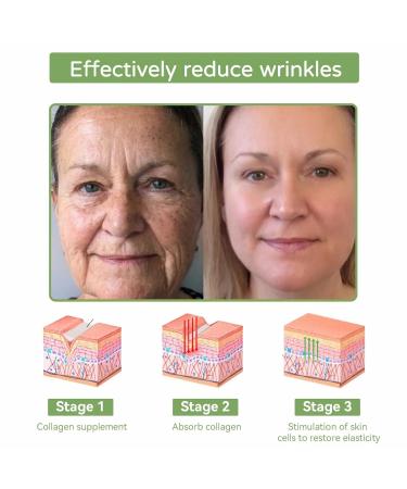 Bee Venom Multi-Purpose Skin Treatment Cream Powerful All-Body skin Cream Intensive skin care and wrinkle reduction (1PC) - Buy Online on GoSupps.com