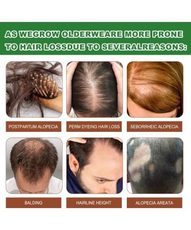  MagiSel Batana Oil Hair Growth Shampoo 100ml strengthening and regrowth formula for men and women with thinning hair or hair loss enriched with rosemary to nourish the - Buy Online on GoSupps.com