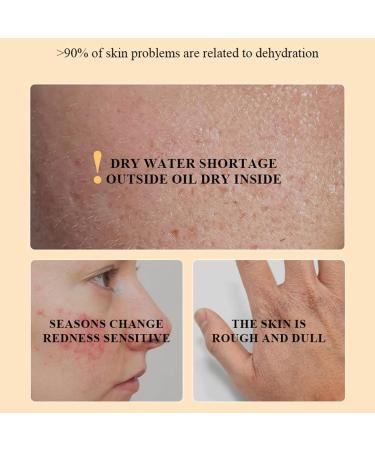  G n rique Beef Tallow for Skin Beef Tallow Moisturizing Cream Skin Care Honey Balm Body Moisturizer for Suitable for All Skin Types 60g (2Pcs A) - Buy Online on GoSupps.com