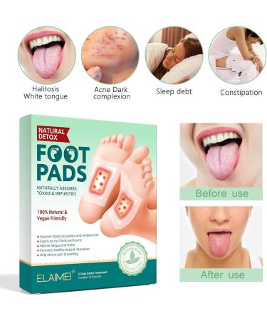 Detox Foot Pads for Stress Relief & Deep Sleep 20 Pieces with Vinegar & Ginger Powder | Improve Sleep Quality & Blood Circulation - Buy Online on GoSupps.com