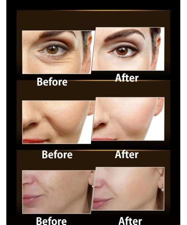 Anti-Wrinkle Firming Black Bandage Cream Black Bandage Hyaluronic Acid Active Peptide Anti-Wrinkle Cream Retinolcollagen Hyaluronic Acid Face Cream Black Bandage Anti-Wrinkle Face Essence (1PC) - Buy Online on GoSupps.com