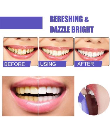 Purple Teeth Brightening Brighter Teeth in 15 Seconds Tooth Stain Removal Cancel Yellow Stains (2Pcs) - Buy Online on GoSupps.com