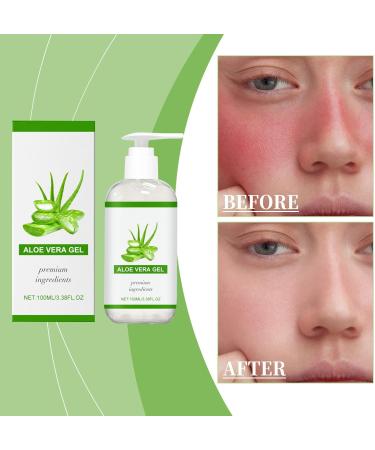  Generisch 100% Pure Aloe Vera Gel - 100ml - Organic aloe vera gel for the face natural moisturizing soothing and nourishing cream - After-sun - Daily moisturizing care (2) - Buy Online on GoSupps.com