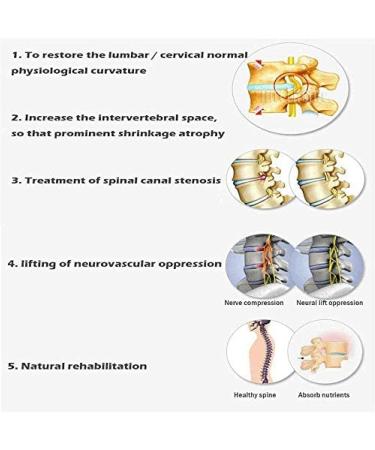 Neck Back Lumbar Traction Device Bed Home Use Cervical Spine Extension Stretcher Device Improve Spine Posture for Spine Alignment and Chronic Neck Pain Relief - Buy Online on GoSupps.com