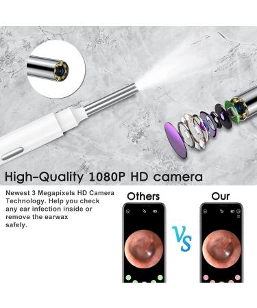 QDCFY OTOSKOK Wireless Endoscopic Camera - Ear Wax Removal Tool with LED for iPhone iPad & Android - Black/White - Buy Online on GoSupps.com