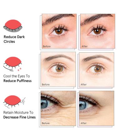 Brightening Eye Mask | Hyaluronic Acid & Caffeine Under Eye Patches for Puffy Eyes & Dark Circles | 60 Patches for Wrinkles & Under Eye Care - Buy Online on GoSupps.com