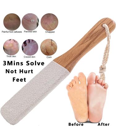 Kinepi Callus Remover Foot Scrubber - Exfoliating Foot File and Pedicure Tool for Smooth, Soft Feet - Pumice Stone for Shower Use - Foot Scraper Kit - Buy Online on GoSupps.com