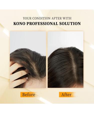 KONO Anti-Dandruff Shampoo - Luxury Series 16.9 OZ | Effective Relief & Hydration for All Hair Types - Shop Now - Buy Online on GoSupps.com