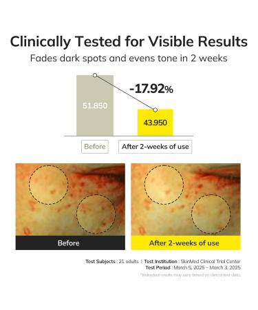 keenoniks Dark Spot Correcting Serum - Brightens Hydrates & Evens Skin Tone - Korean skincare 30ml (1.01 Fl Oz) - Buy Online on GoSupps.com