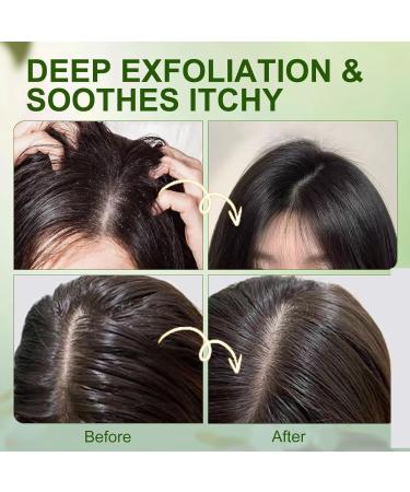 Le shampoing exfoliant au romarin limine les pellicules et les r sidus de produits apaise le cuir chevelu r duit l'exc s de s bum favorise la pousse des cheveux convient aux cheveux clairsem s - Buy Online on GoSupps.com