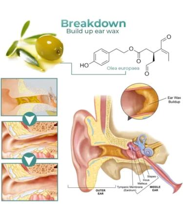 IEXUX Anti Cochlear Blockage Removal Spray - Earwax Removal Drops for Clogged Ears (3PCS) - Buy Online on GoSupps.com