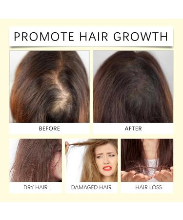  Clawrex Hair Growth Oil natural essential oil for hair stimulates hair growth and against hair loss nourishes the scalp promotes hair volume soothes and - Buy Online on GoSupps.com