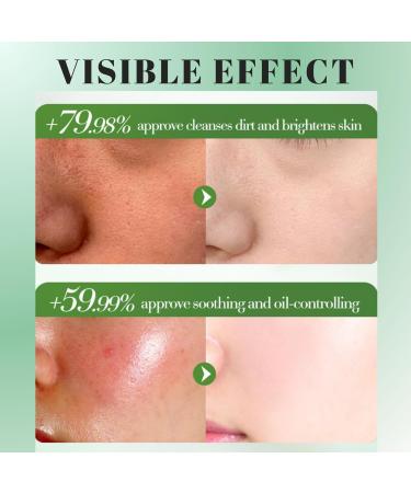 Natural Aloe Vera Gel for Face Pure Aloe Vera Gel Aloevera Gel for Skin Soothing Aloe Vera Face Gel for Women & Men Aloe Vera After Sun Body Face Care for Sunburn Repair Scars Restoring 160g - Buy Online on GoSupps.com