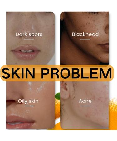 Kojic Acid & Turmeric Soap - Kojic Acid Soap for Women - Tumeric Soap Acne Dark spots Hyperpigmentation Smooth Skin - Deep Cleanses and Nourishes - Buy Online on GoSupps.com