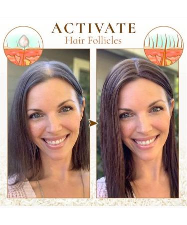 Puraect Fermented Rice Water Serum for Hair Growth - Biotin Hair Loss Solution | Thinning Hair Treatment (1 PC) - Buy Online on GoSupps.com