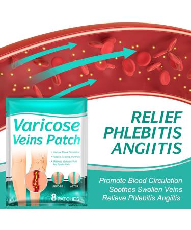 Remove Varicose Veins 16 Pcs Spider Vein Patch | Effective Treatment for Legs Care - Buy Online on GoSupps.com
