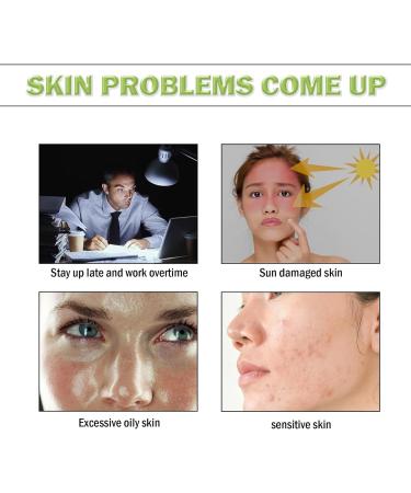 Azelaic Acid Balancing Serum Aloe Vera Moisturiser Face Serum Collagen Serum for Face Remove Blackhead Redness Relief and Acne Blemish Control Fade and Repair Dark Spots Skin Moisturizer - Buy Online on GoSupps.com