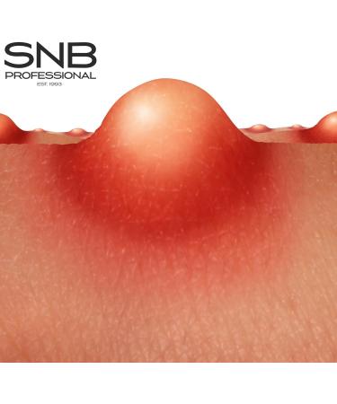  NAILUP by SNB SNB Professional RIAZ Soothing Cream 100 with Moringa Oil Zeolite Propolis Extract Allantoin Ichthyol | Skin and Facial Care | Face Cream | With 85% Natural Ingredients - Buy Online on GoSupps.com