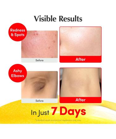 EQQUALBERRY Vitamin Illuminating Serum 30ml S rum Visage clat avec Vitamine C d Acerola Niacinamide et Arbutine Hydratation et Teint Uniforme Soin Cor en - Buy Online on GoSupps.com