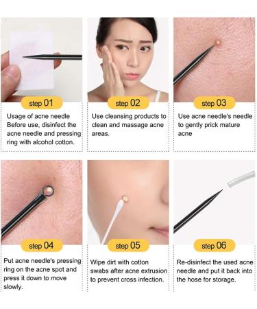 Professional Blackhead Remover Tool Kit for Nose & Face with Case - Acne Comedone Zit Extractor Set - Blemish Pimple Popper Tool - Blackhead Extraction Popping Tool - Buy Online on GoSupps.com