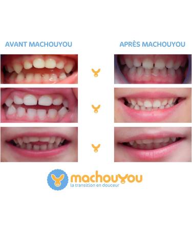 Machouyou Teething Ring - Buy Online on GoSupps.com