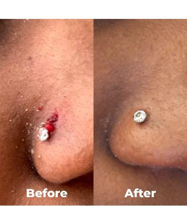 BrioCare Pierce Pro Gentle Saline Spray for Piercing & Body Mod Aftercare | Soothe Redness & Itch, Reduce Bumps | Hypochlorous HOCl Spray by BRIOTECH - Buy Online on GoSupps.com