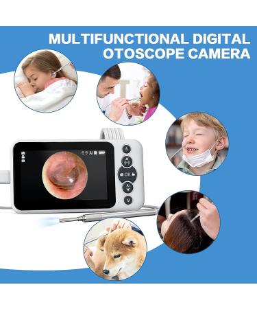 AI Intelligent Visual Digital Otoscope Hiacinto | Ear Wax Removal Tool 4.5 IPS Screen Camera | Gyroscope & Recording | 32GB Card & Cleaning Kits - Buy Online on GoSupps.com