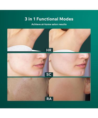 Aminz IPL Hair Removal Device with LCD Touchscreen - 999 900 Flashes 9 Energy Levels Painless Laser Treatment for Face Bikini & Body - International Shipping Available - Buy Online on GoSupps.com