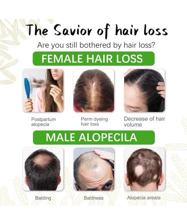 Rice Water Growth Shampoo & Conditioner - Biotin Caffeine Rosemary for Hair Loss - Sulfate-Free Formula for Men & Women - Boost Hair Growth - Buy Online on GoSupps.com