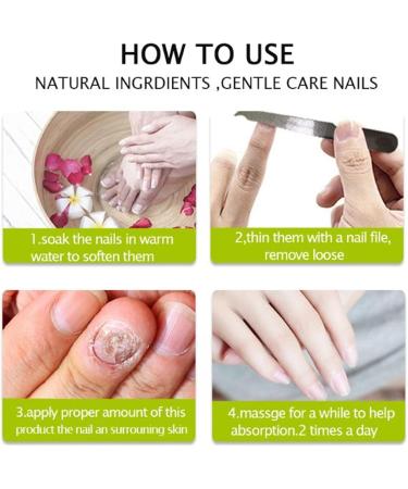  DUBUSH Narc Paronychia Repairing Nail Care Gel restores the appearance of discolored or damaged nails. Instant beauty gel. - Buy Online on GoSupps.com