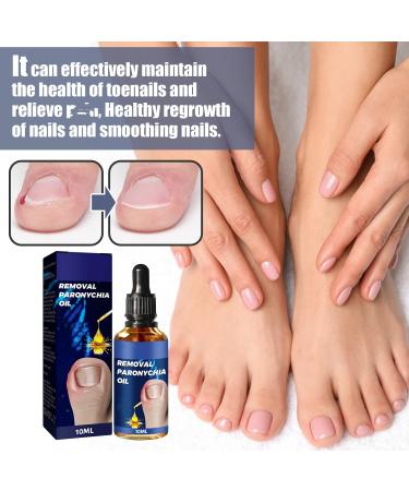 German Toenailcare Removal Oil | Paronychia & Ingrown Toenail Repair | Anti-Paronychia Relief Liquid for Nail Renewal - Buy Online on GoSupps.com