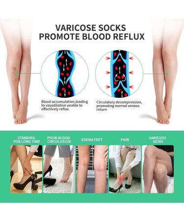 Women's 20-30mmHg Compression Pantyhose - Beige L | Relief for Swelling, Edema, Varicose Veins - Buy Online on GoSupps.com