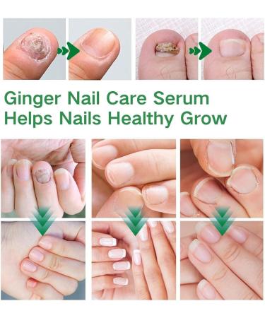 Nail Strengthener Oil Lightweight Natural Nail Gel 30ml Nutrition Repair with Fast Absorbing Formula Botanical Strengthening Care for Weak Brittle Nails Home Salon Beauty for Women - Buy Online on GoSupps.com