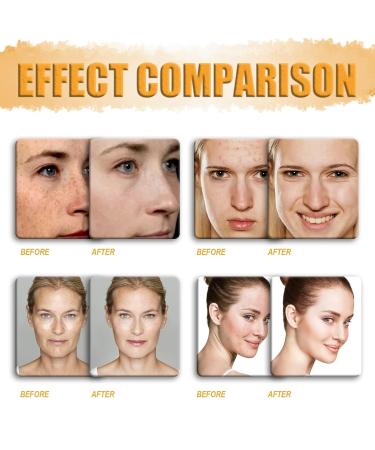 Phor Essentials Turmeric Kojic Acid Pads - 10PCS Cleansing Pads for Brightening & Skin Tone Evenness - Buy Online on GoSupps.com