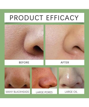  SONGVISON Pack of 60 blackhead removal strips (30g) - To remove blackheads and open pores - For all skin types - For men and women - Buy Online on GoSupps.com